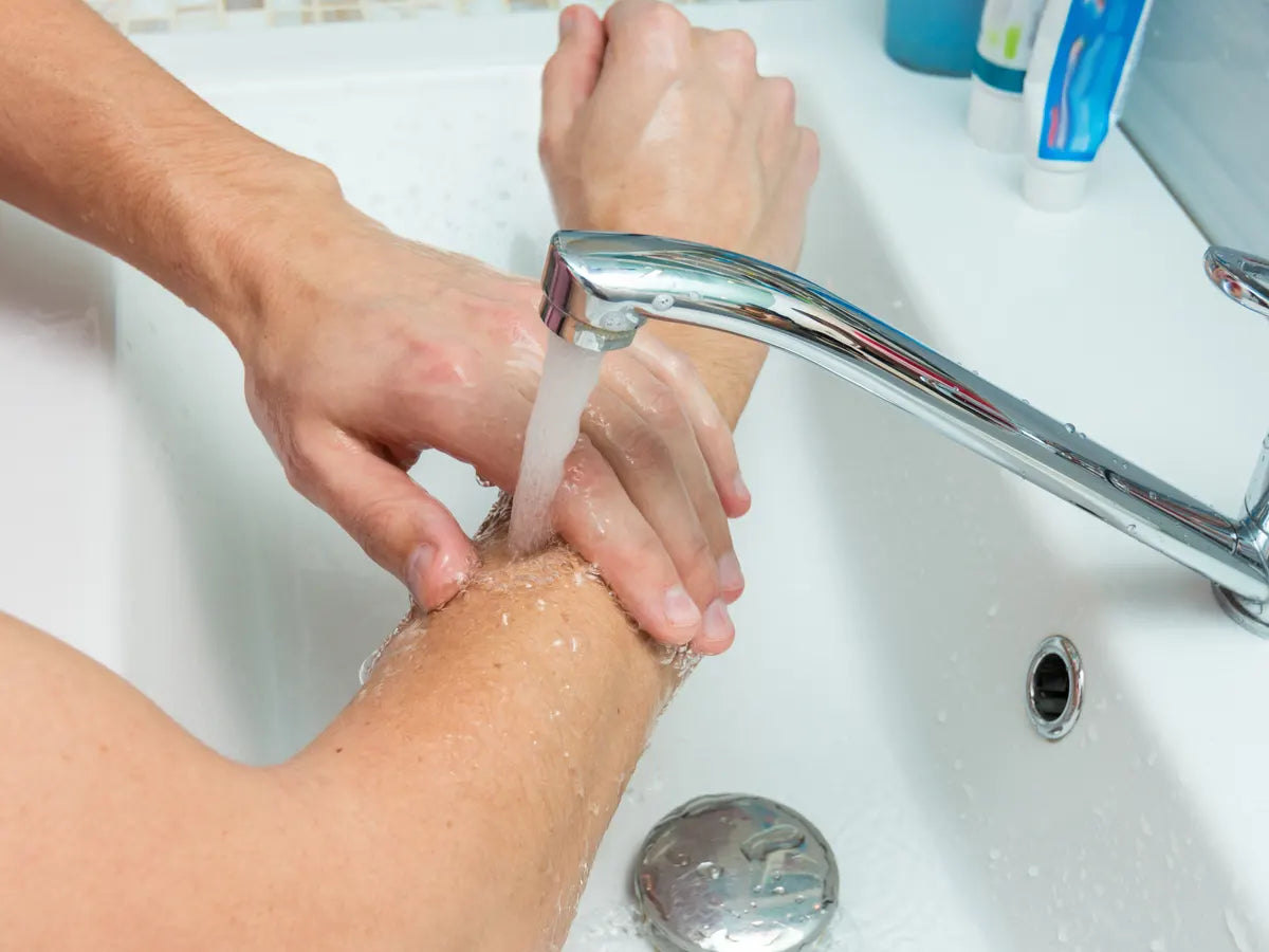 Treatment of blisters