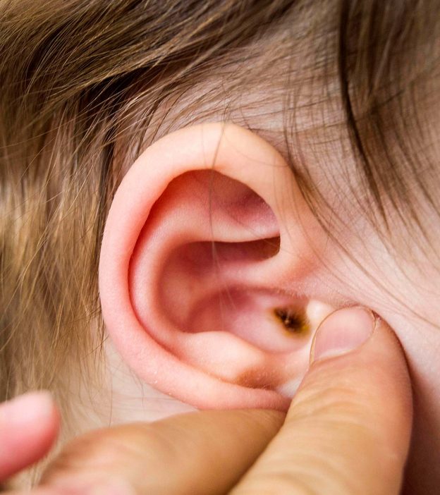 How to remove earwax
