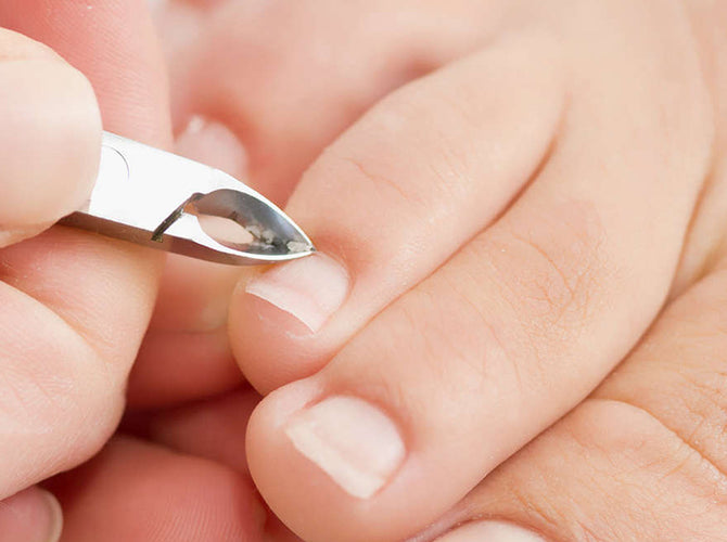 What Are the Signs and Symptoms of Fungal Nail Infections? - StoryMD
